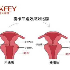 缩阴产品效果真的好吗？怎么用详解！