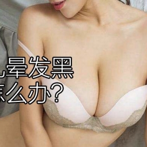 乳晕发黑怎么办？如何淡化乳晕黑色素