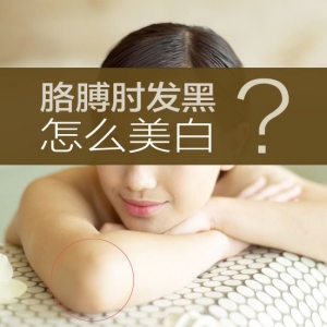 胳膊肘子黑怎么变白？探讨手肘黑美白小妙招