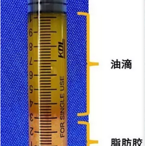 禾美嘉任学会院长：自体脂肪面部填充改善面部显老元凶之首法令纹 ...